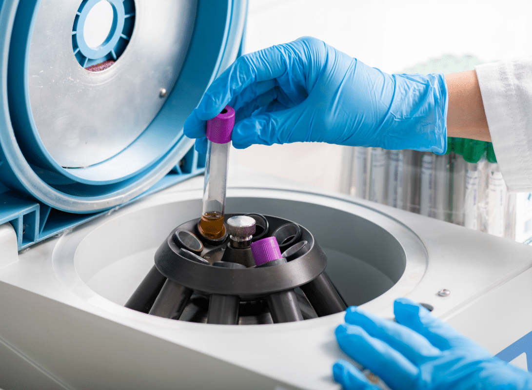 Untitled design 8 1091x800 - Understanding the Technology behind High-Speed Centrifugation